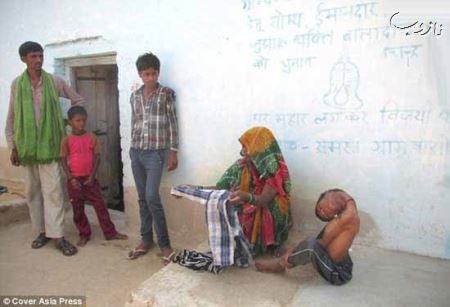(18-) پسری 12 ساله با سری برعکس (عکس)