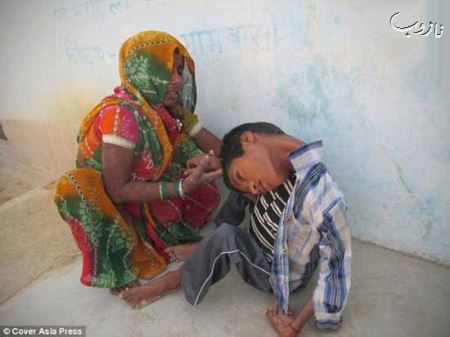 (18-) پسری 12 ساله با سری برعکس (عکس)