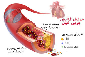 بهترین گیاه برای کاهش چربی خون بهترین گیاه برای کاهش چربی خون
