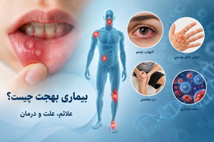 بیماری بهجت چیست؟ علائم، علت و درمان