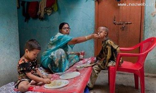 عکس های دیدنی پسر 14 ساله با بدنی 110 ساله!!