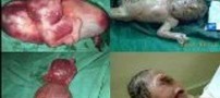 بچه ی قورباغه نما (18+)