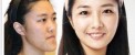 عکس باورنکردنی تغییر چهره ۳ دختر بعد از عمل زیبایی!