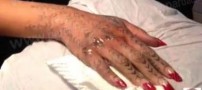 خالکوبی جدید خواننده مشهور به روشی دردناک! عکس