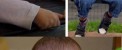 پسری که روی سرش شاخ های واقعی دارد !(عکس)