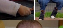 پسری که روی سرش شاخ های واقعی دارد !(عکس)