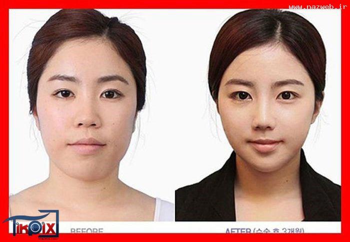 عکسهای جنجالی دختران جذاب کره ای بعد از جراحی