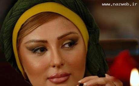 عکس های دیده نشده نیوشا ضیغمی بعداز عمل زیبایی