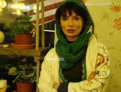 چهره شوکه کننده نگار فروزنده پس ازجراحی مجدد