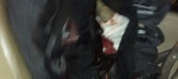 تصویر معاون وزیر پس از سوء قصد (18+)