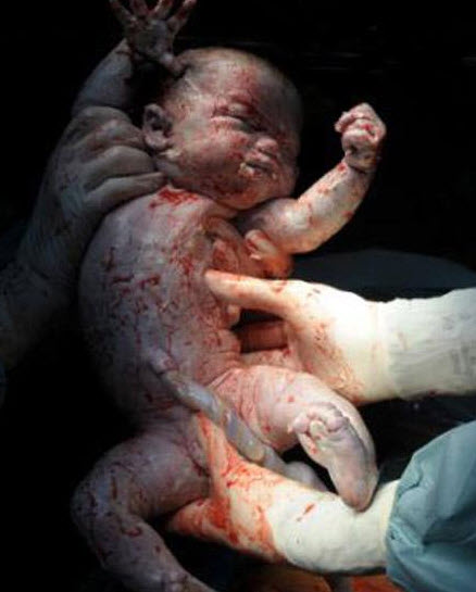 عکس های باورنکردنی از لحظه ی تولد نوزاد