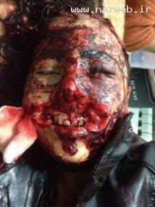 شکنجه بی رحمانه و وحشتناک این ستاره + عکس