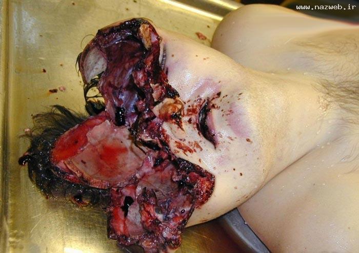 14+ عکس های وحشتناک سرهای از بین رفته انسان