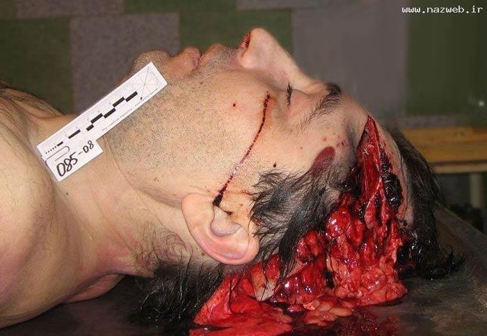 14+ عکس های وحشتناک سرهای از بین رفته انسان