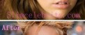 عکس های جنجالی مایلی سایرس قبل و بعد از جراحی