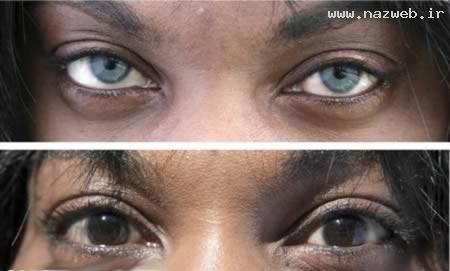 6 عمل جراحی بسیار عجیب و خنده دار این افراد! عکس