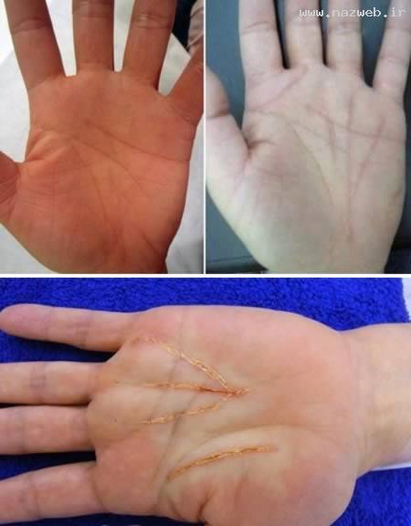 6 عمل جراحی بسیار عجیب و خنده دار این افراد! عکس