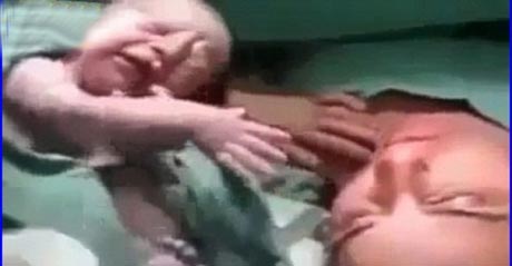 صحنه ی باور نکردنی بدنیا آمدن یک نوزاد +تصاویر