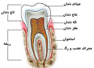 علت درد دندان بعد از عصب کشی چیست
