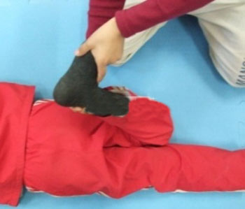 علل بوجود آمدن زانوهای پرانتزی ! (+ تصاویر)