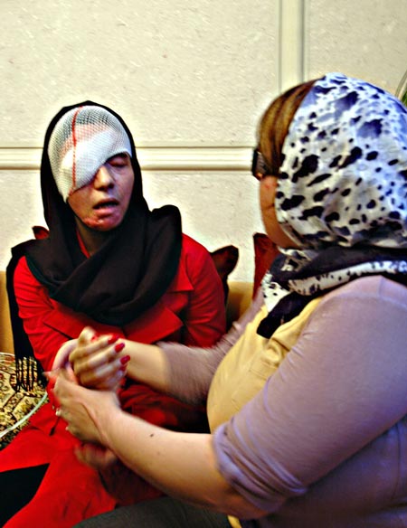 حکم قصاص چشم پدر شوهر معصومه + عکس دلخراش