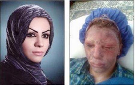 حکم قصاص چشم پدر شوهر معصومه + عکس دلخراش حکم قصاص چشم پدر شوهر معصومه + عکس دلخراش