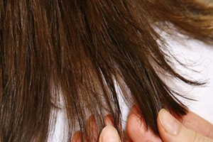 پیشگیری از موخوره با ماسک های طبیعی