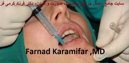 تصاویر عمل جراحی پروتز لب یک خانم (دلخراش 18+)
