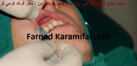 تصاویر عمل جراحی پروتز لب یک خانم (دلخراش 18+)