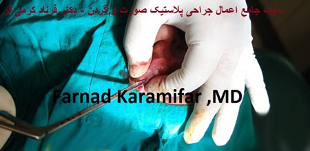 تصاویر عمل جراحی پروتز لب یک خانم (دلخراش 18+)