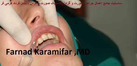 تصاویر عمل جراحی پروتز لب یک خانم (دلخراش 18+)