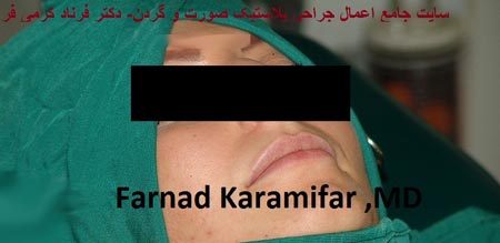 تصاویر عمل جراحی پروتز لب یک خانم (دلخراش 18+)
