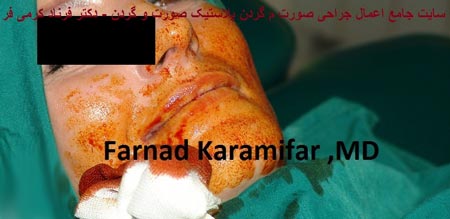تصاویر عمل جراحی پروتز لب یک خانم (دلخراش 18+)