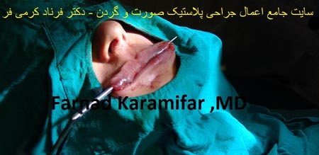 تصاویر عمل جراحی پروتز لب یک خانم (دلخراش 18+)