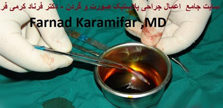 تصاویر عمل جراحی پروتز لب یک خانم (دلخراش 18+)