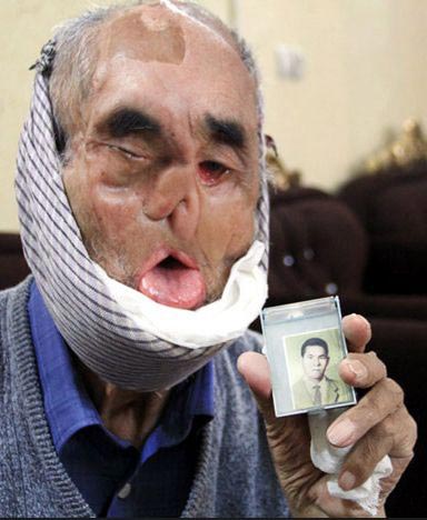 جانبازی با چهره ی عجیب ! (عکس]
