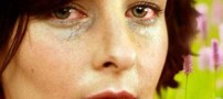 علائم آلرژی چشم و درمان آن