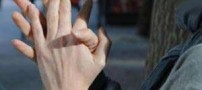 علت های خواب رفتن دست و پاها