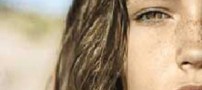 برای جلوگیری و پیشگیری از کک و مک چه کنیم