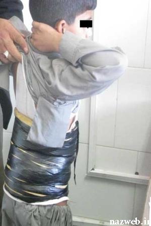جاسازی عجیب 3 کیلو تریاک در بدن این پسر بچه!! + عکس