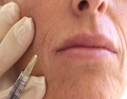 خطرات و اثرات جدی تزریق بوتاکس را بدانید