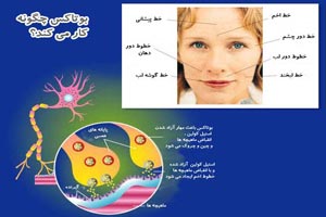 بوتبوتاکس چیست و چه عوارضی دارد