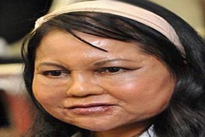 28 سالگی این زن و چهره 70 ساله ی او ! + عکس