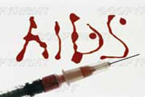 راه های انتقال و تشخیص ایدز چیست