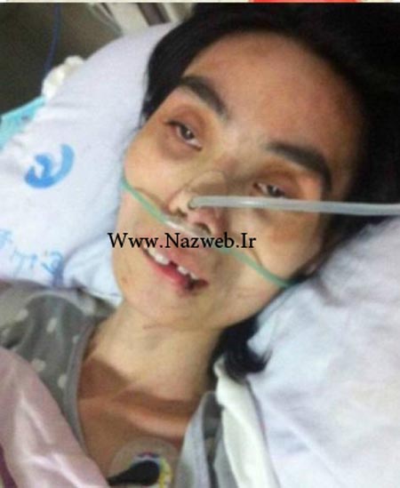 اندام فجیع و شوکه کننده دختر 26 ساله پوست و استخوان + تصاویر