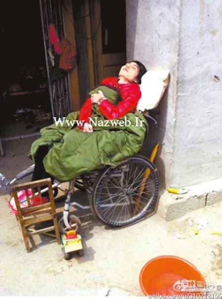 اندام فجیع و شوکه کننده دختر 26 ساله پوست و استخوان + تصاویر