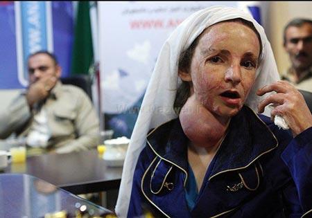 جدیدترین عکس های دختران سوخته ی شین آباد