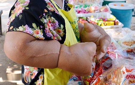 اندام عجیب زن تایلندی + عکس