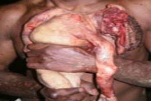کودکی که توسط پدرش زنده زنده خورده شد!! + عکس