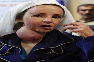 جدیدترین عکس های دختران سوخته ی شین آباد